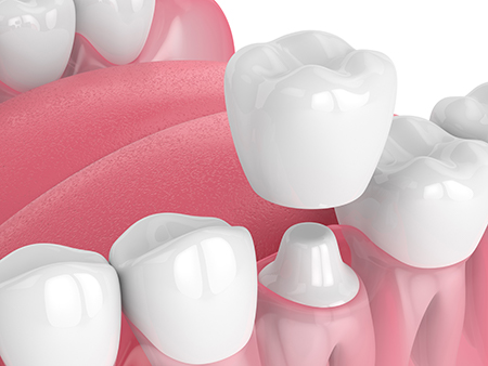 Martineau Family Dentistry