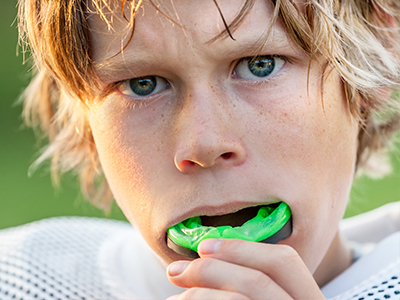 Granger Dentistry | Implant Restorations, Sports Mouthguards and Laser Dentistry